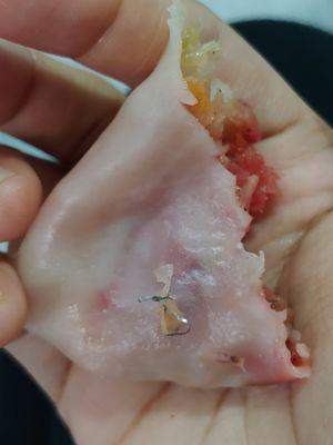 Metal shard in dumpling