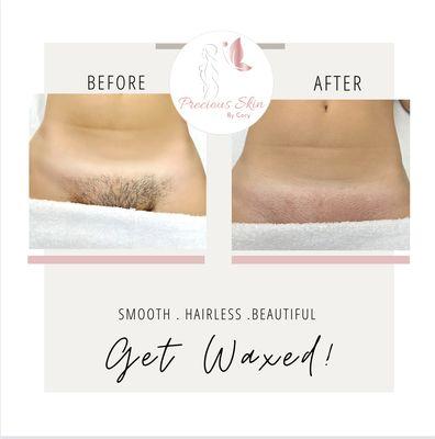 Get waxed and enjoy a smoother skin!