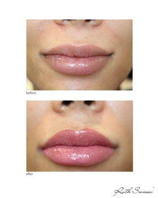 Permanent lip blush (permanent lipstick/full lips technique) to make the lips appear fuller, more vibrant and symmetrical