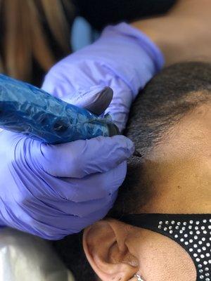 Up close.. Scalp Micropigmentation