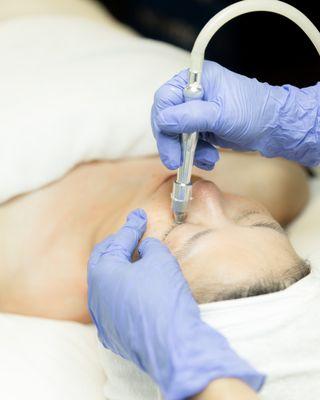 Microdermabrasion to exfoliate the outer layer of the skin to improve its texture and appearance.