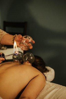 Fire Cupping! If you have pain or even asthma we can help