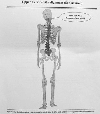 Upper Cervical Misalignment