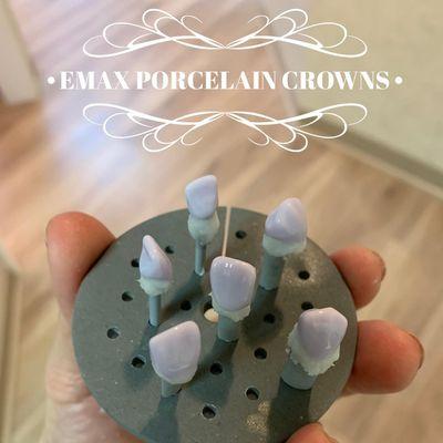 Emax porcelain crowns