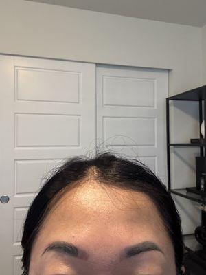 inner corner brows (after)  1 treatment