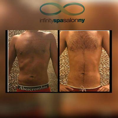 Another satisfied client who partook in our cavitation treatments! We treat all body types in order to sculpt your body to look it's best