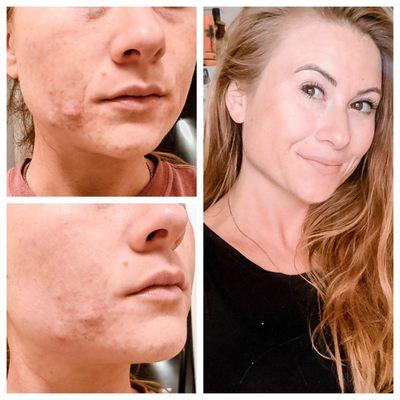 Medical-grade skincare before and after