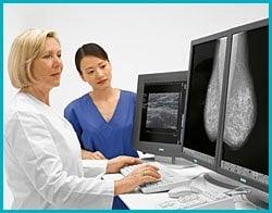 Digital Mammography