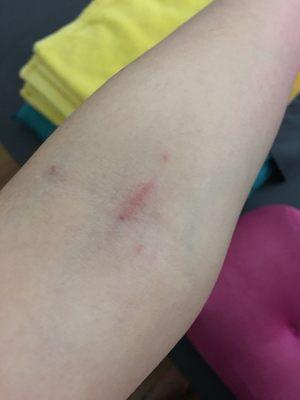 Aftershock of the rude nurse who took bloodwork