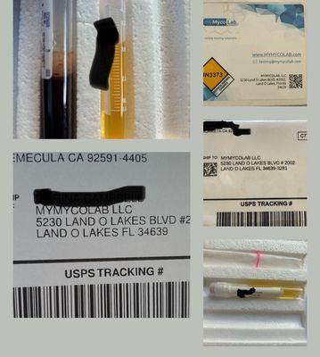 MyMycolab blood sample kits.