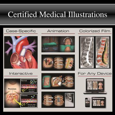 Certified Medical Illustrations & Animations