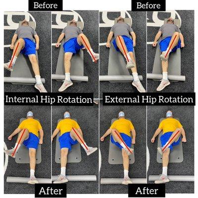 Hip Mobility: Before & After