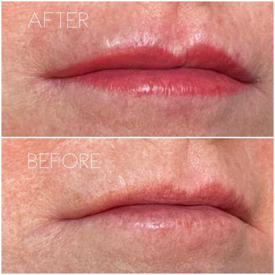 Permanent Makeup, lip blushing. Lip blushing has helped to create more symmetry on her lips