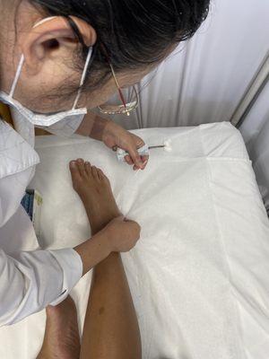 Dr. Dongmei needling the ankle