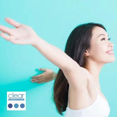 Underarm Laser Hair removal