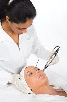 Microneedling for facial rejuvenation.