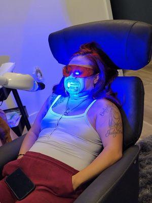 Teeth Whitening Session