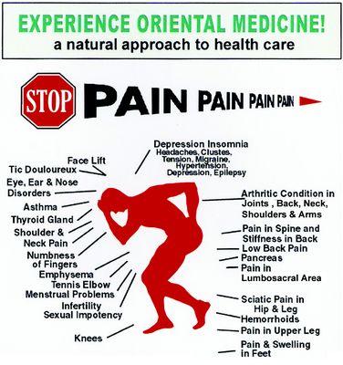 Stop Pain With Acupuncture