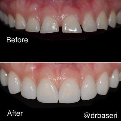 Smile Recreation by Dr. Bernard Baseri