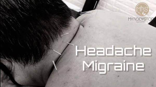 Neck pain,headache, Migraine
 Best Acupuncturist