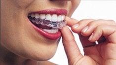 Invisalign