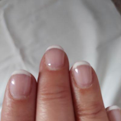 Dead skin around cuticles, and crooked lines.