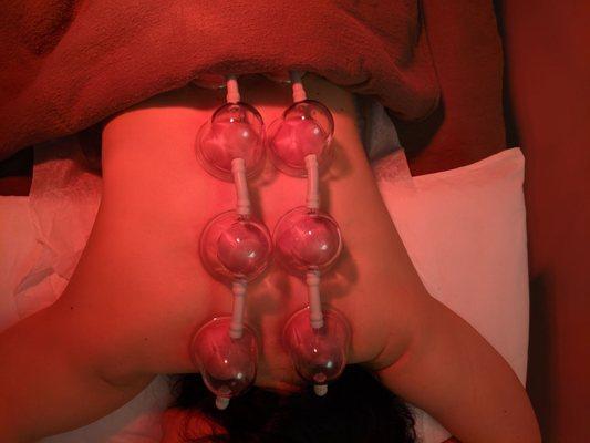 Automated Massage Cupping will relax your back and mind!