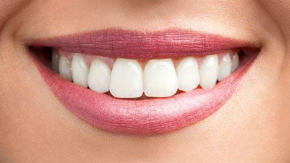 Cosmetic Dentist Framingham MA