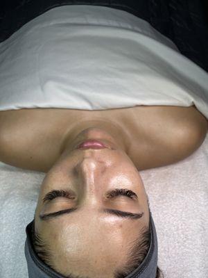 Hydradermabrasion Facial by Claudia