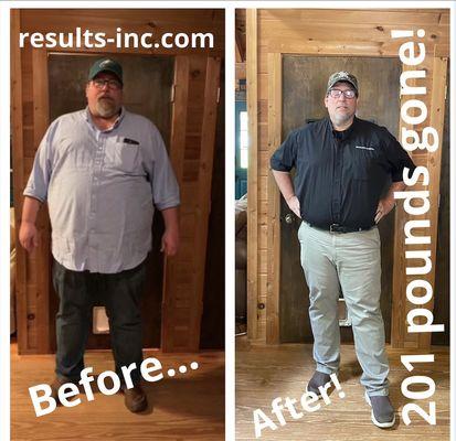 Amazing transformation!  201 pounds gone!