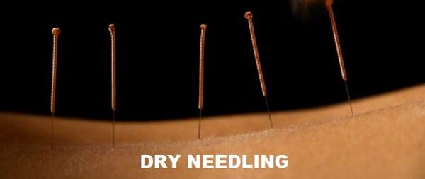 Dr. Huh is a Dry Needling certified practitioner.