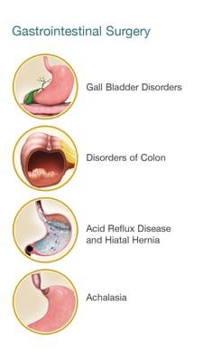 Surgery for disorders of Gall bladder, Colon (cancer, diverticulitis), Acid reflux, etc