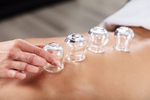 Cupping Therapy Improve Circulation & Relieve Muscle Discomfort