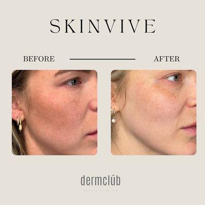 Dermclub