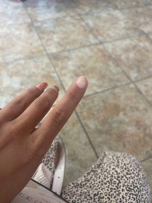 broken nail