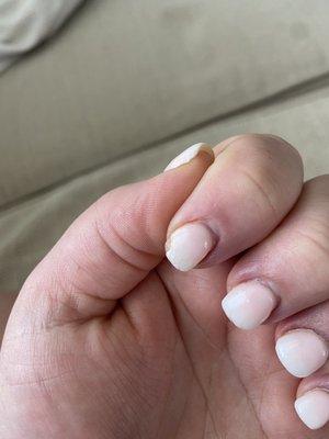 chipped nail and cracks visible on the white part, especially on my index and middle finger.