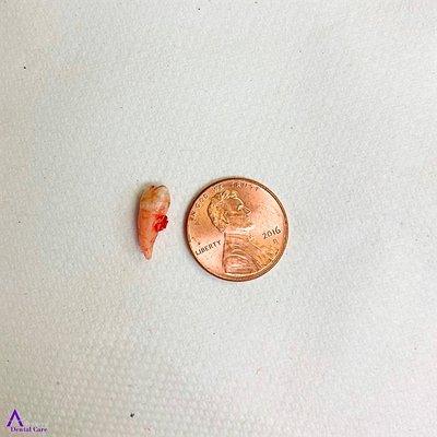 We extract wisdom teeth big and small - even smaller than a penny! Schedule with our oral surgeon today!