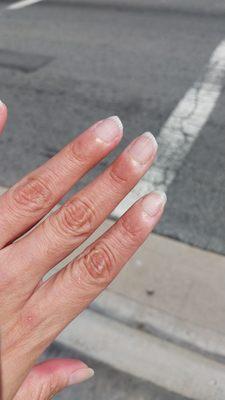 Very badly shaped nails