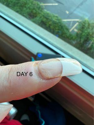 Day 6 & almost every nail had this kind of huge lifting issue & looked like straight trash.