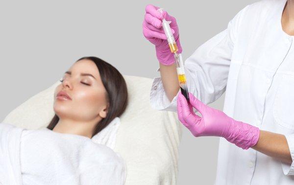 PRP FACIAL