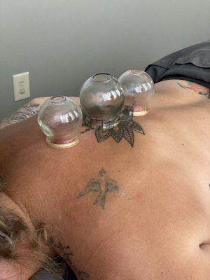 Glass cups used in cupping therapy treatments.