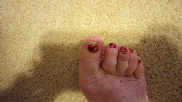 would not paint my big toe