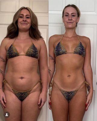 Weight loss injections results