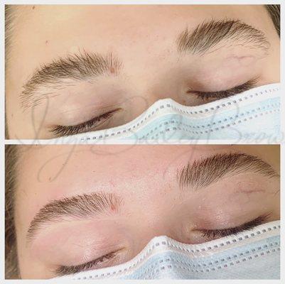 Before and after on teen brows - all natural