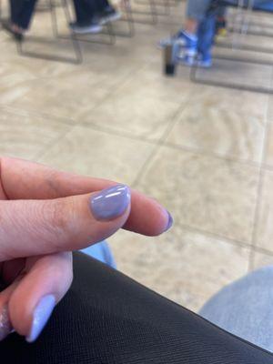 My other thumb with grooves and unevenness