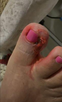 ‼My mom contracted a severe toe infection after visiting this salon in May.‼ It doesn't let me upload other pictures I have