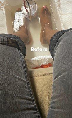 Aqua Chi Foot Detox!