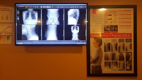 state of the art digital X-rays and viewing screen