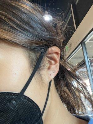 Bleeding mispierced ear (first hole)