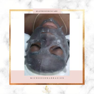 Microdermabrasion Facial with Hydrating Hyaluronic Mask treatment